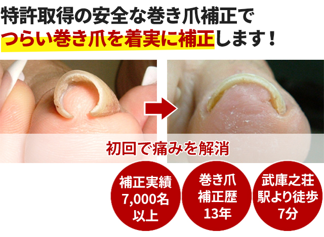 尼崎市,武庫之荘駅の接骨院